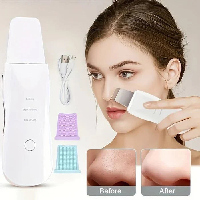 PALETA ULTRASONICA PARA ROSTRO